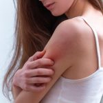 Intepatura de tzantar sange hran si efecte