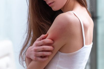 Intepatura de tzantar sange hran si efecte