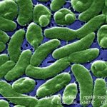 O bacterie carnivora provoaca panica pe coasta Floridei