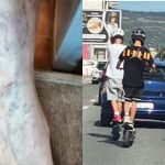 femeie de 66 de ani lovita de un copil pe trotineta