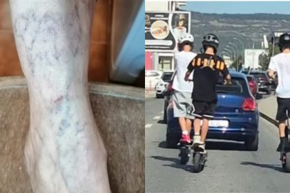 femeie de 66 de ani lovita de un copil pe trotineta