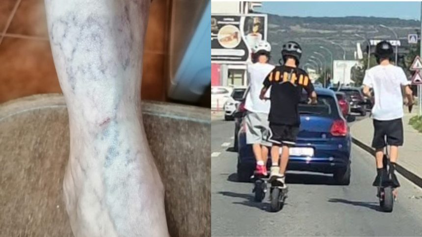 femeie de 66 de ani lovita de un copil pe trotineta