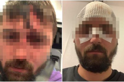 Scandal pe strada la Rosia Trei barbati spitalizati