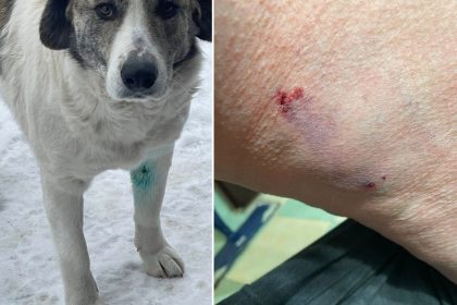 Femeie din Sura Mare muscata de caini proprii