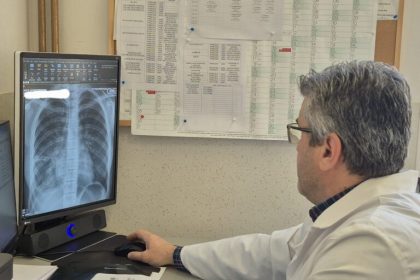 Avertisment din partea unui medic din Sibiu radiografia pulmonara nu este o procedura de rutina