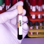 Rolul AMH in evaluarea rezervei ovariene