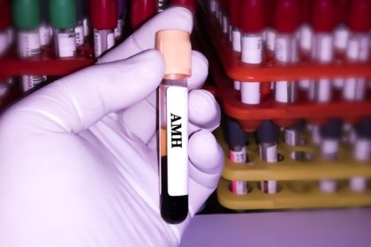 Rolul AMH in evaluarea rezervei ovariene