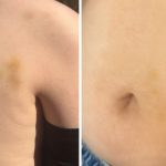 cazul copilului agresat de tatal unui coleg in parc la sibiu are fractura nazala iar mama a solicitat ordin de protectie